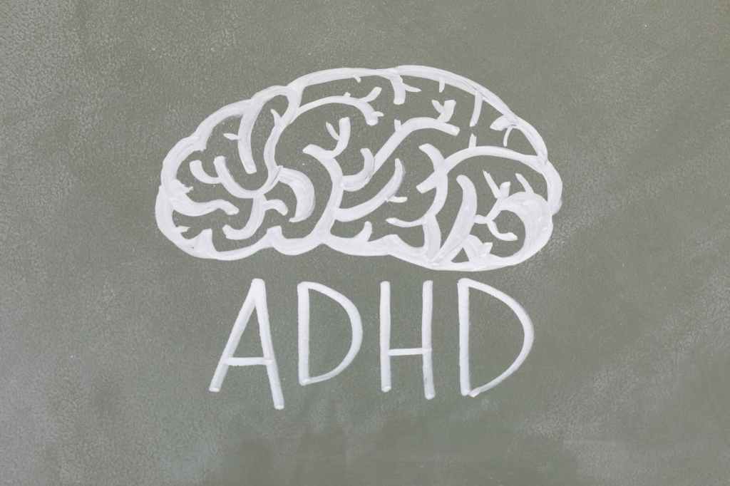 ADHD 生產力指南